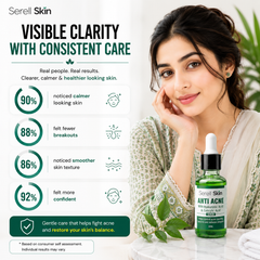 Serell Skin Anti Acne Serum for oily acne prone skin Pakistan